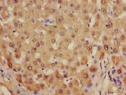 Invitrogen Alcohol Dehydrogenase 1B Polyclonal Antibody 100 &mu;g; Unconjugated:Antibodies,