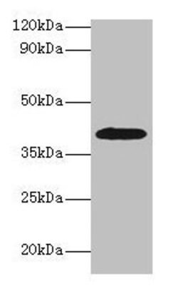 Invitrogen Alcohol Dehydrogenase 1B Polyclonal Antibody 100 &mu;g; Unconjugated:Antibodies,