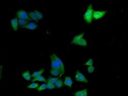 Invitrogen ADH7 Polyclonal Antibody 100 &mu;g; Unconjugated:Antibodies,