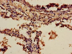 Invitrogen ADH7 Polyclonal Antibody 100 &mu;g; Unconjugated:Antibodies,