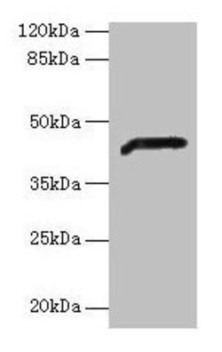 Invitrogen ADH7 Polyclonal Antibody 100 &mu;g; Unconjugated:Antibodies,