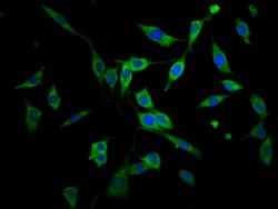 AGPS Polyclonal Antibody:Anticuerpos