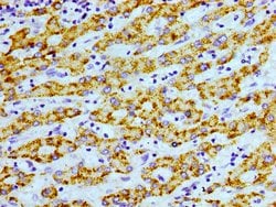 Invitrogen AGXT Polyclonal Antibody 100 &mu;g; Unconjugated:Antibodies,