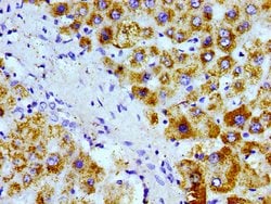 Invitrogen AGXT Polyclonal Antibody 100 &mu;g; Unconjugated:Antibodies,