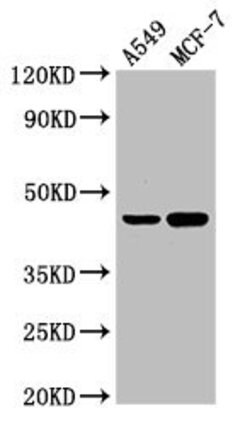 Invitrogen AGXT Polyclonal Antibody 100 &mu;g; Unconjugated:Antibodies,