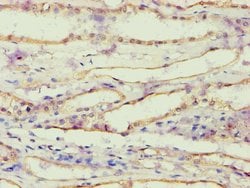 Invitrogen AKR1B10 Polyclonal Antibody 100 &mu;L; Unconjugated:Antibodies,
