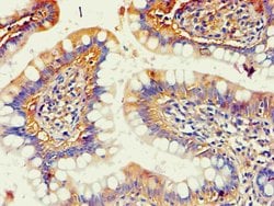 Invitrogen AKR1B10 Polyclonal Antibody 100 &mu;L; Unconjugated:Antibodies,