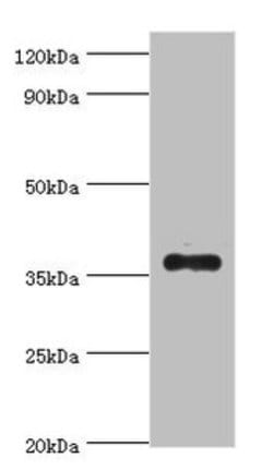 Invitrogen AKR1B10 Polyclonal Antibody 100 &mu;L; Unconjugated:Antibodies,