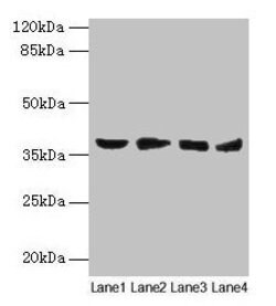 Invitrogen AKR1C2 Polyclonal Antibody 100 &mu;g; Unconjugated:Antibodies,