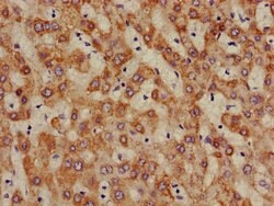 Invitrogen ALDH5A1 Polyclonal Antibody 100 &mu;g | Buy Online | Invitrogen&trade; | Fisher Scientific