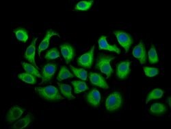 Invitrogen ALOX12 Polyclonal Antibody 100 &mu;g; Unconjugated:Antibodies,