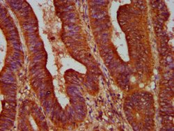 Invitrogen ALOX12 Polyclonal Antibody 100 &mu;g; Unconjugated:Antibodies,