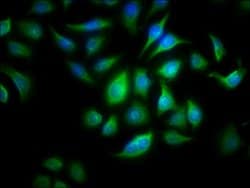 Invitrogen ALOX15B Polyclonal Antibody 100 &mu;g; Unconjugated:Antibodies,