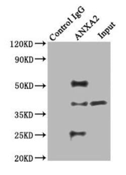 Invitrogen Annexin A2 Polyclonal Antibody 100 &mu;g; Unconjugated:Antibodies,