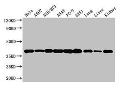 Invitrogen Annexin A2 Polyclonal Antibody 100 &mu;g; Unconjugated:Antibodies,