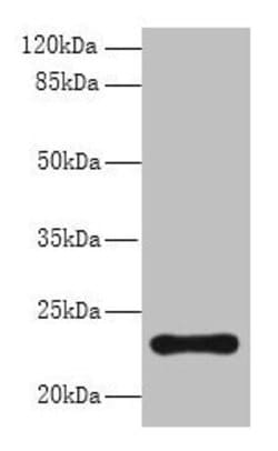 Invitrogen AP3S2 Polyclonal Antibody 100 &mu;g | Buy Online | Invitrogen&trade; | Fisher Scientific