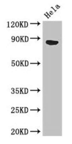 Invitrogen APEH Polyclonal Antibody 100 &mu;g; Unconjugated:Antibodies,