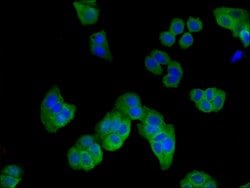 Invitrogen D4-GDI Polyclonal Antibody 100 &mu;g | Buy Online | Invitrogen&trade; | Fisher Scientific
