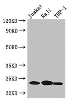 Invitrogen D4-GDI Polyclonal Antibody 100 &mu;g | Buy Online | Invitrogen&trade; | Fisher Scientific