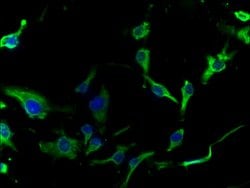 Invitrogen ASAH2 Polyclonal Antibody 100 &mu;g; Unconjugated:Antibodies,