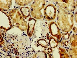 Invitrogen ASAH2 Polyclonal Antibody 100 &mu;g; Unconjugated:Antibodies,
