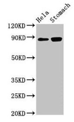 Invitrogen ASAH2 Polyclonal Antibody 100 &mu;g; Unconjugated:Antibodies,