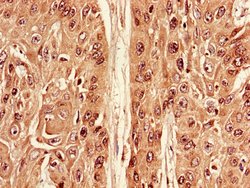 Invitrogen ATG7 Polyclonal Antibody 100 &mu;g | Buy Online | Invitrogen&trade; | Fisher Scientific