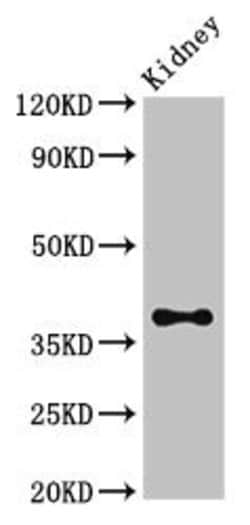 ATOH1 Polyclonal Antibody:Antibodies, Polyclonal