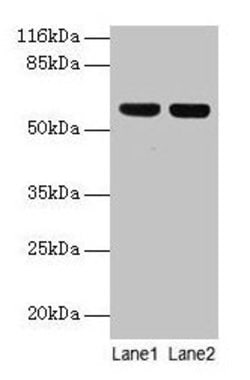 Invitrogen ATP5A1 Polyclonal Antibody 100 &mu;g | Buy Online | Invitrogen&trade; | Fisher Scientific