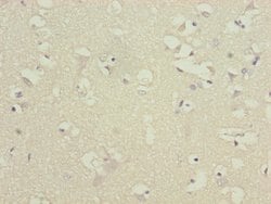 Invitrogen ATP5D Polyclonal Antibody 100 &mu;L; Unconjugated:Antibodies,