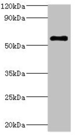 Invitrogen ATP6V1B2 Polyclonal Antibody 100 &mu;L; Unconjugated:Antibodies,