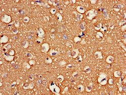 Invitrogen ATP6V1G2 Polyclonal Antibody 100 &mu;g; Unconjugated:Antibodies,