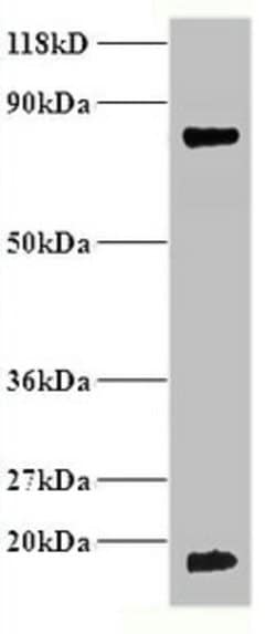 Invitrogen Hemoglobin Polyclonal Antibody 100 &mu;g; Unconjugated:Antibodies,