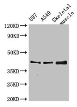 Invitrogen B3GALT4 Polyclonal Antibody 100 &mu;g; Unconjugated:Antibodies,