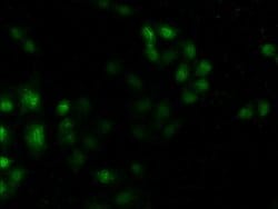 Invitrogen MST3 Polyclonal Antibody 100 &mu;g; Unconjugated:Antibodies,