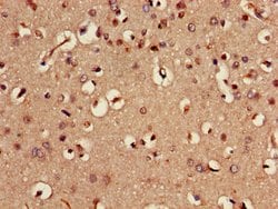 Invitrogen MST3 Polyclonal Antibody 100 &mu;g; Unconjugated:Antibodies,