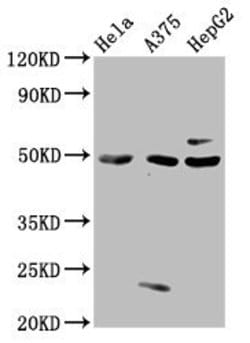 Invitrogen MST3 Polyclonal Antibody 100 &mu;g; Unconjugated:Antibodies,