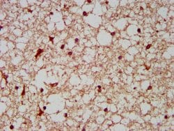 Invitrogen BCKDHA Polyclonal Antibody 100 &mu;g; Unconjugated:Antibodies,