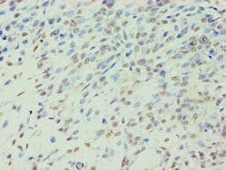 Invitrogen BCKDK Polyclonal Antibody 100 &mu;L; Unconjugated:Antibodies,