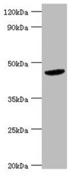 Invitrogen BCKDK Polyclonal Antibody 100 &mu;L; Unconjugated:Antibodies,
