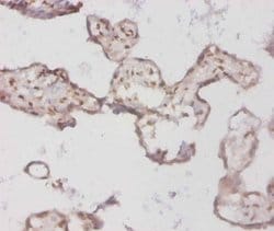 Invitrogen BMP-3 Polyclonal Antibody 100 &mu;g; Unconjugated:Antibodies,