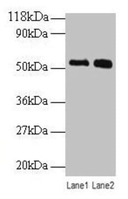 Invitrogen BMP-3 Polyclonal Antibody 100 &mu;g; Unconjugated:Antibodies,