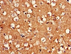 Invitrogen BRCC3 Polyclonal Antibody 100 &mu;g; Unconjugated:Antibodies,