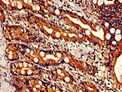 Invitrogen BRCC3 Polyclonal Antibody 100 &mu;g; Unconjugated:Antibodies,