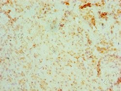 Invitrogen BRCC3 Polyclonal Antibody 100 &mu;g; Unconjugated:Antibodies,