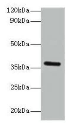 Invitrogen BRCC3 Polyclonal Antibody 100 &mu;g; Unconjugated:Antibodies,