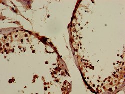 Invitrogen C19orf47 Polyclonal Antibody 100 &mu;g; Unconjugated:Antibodies,