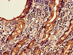 Invitrogen C19orf47 Polyclonal Antibody 100 &mu;g; Unconjugated:Antibodies,