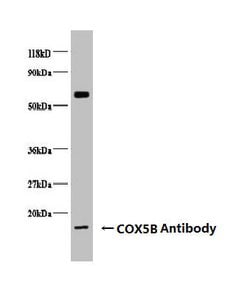 Invitrogen COX5B Polyclonal Antibody 100 &mu;g | Buy Online | Invitrogen&trade; | Fisher Scientific