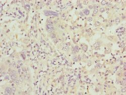 Invitrogen C8B Polyclonal Antibody 100 &mu;L; Unconjugated:Antibodies,
